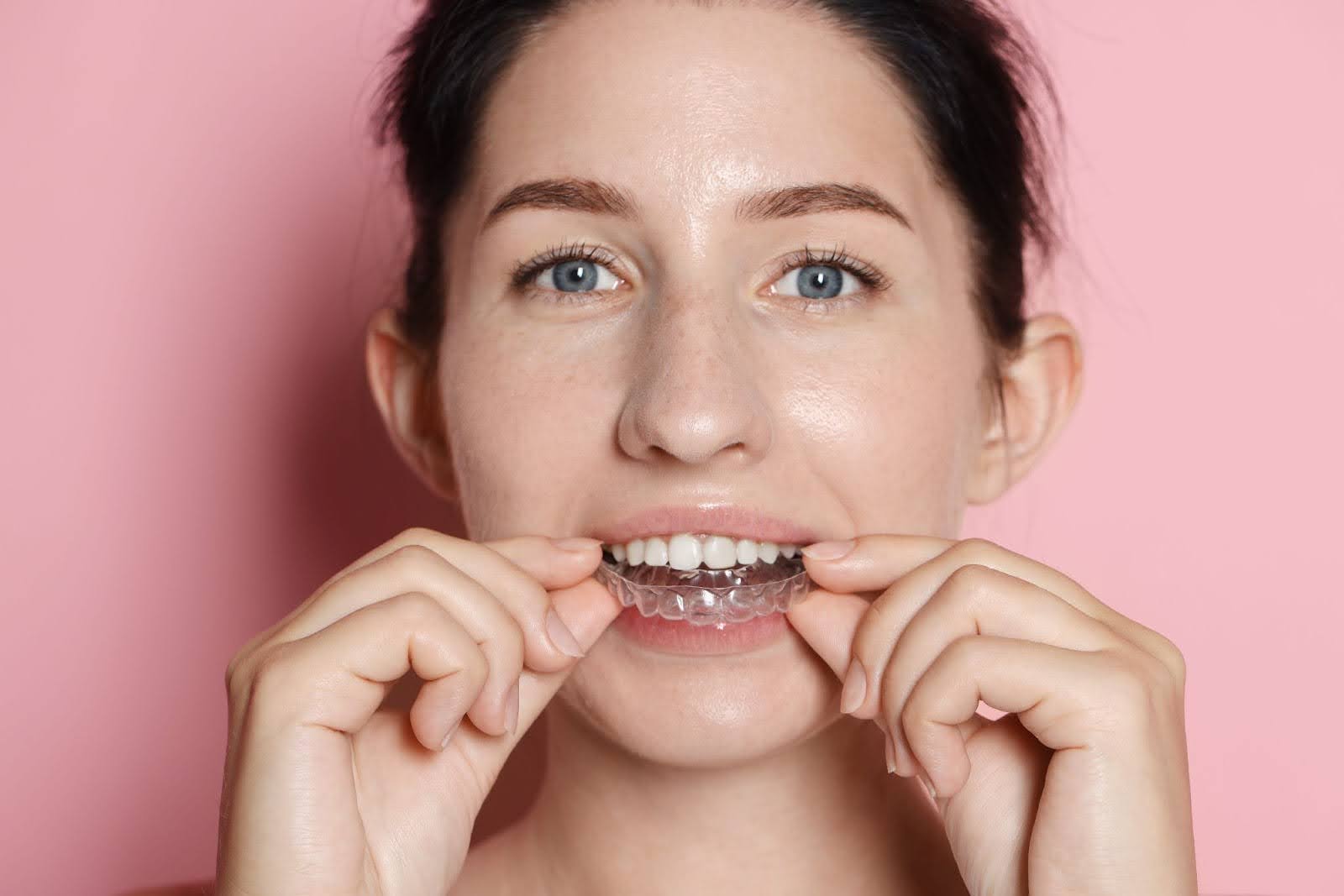 orthodontie-invisible